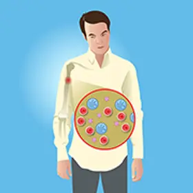 Entdecken Sie Multiple Myelom-Studien