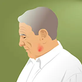 Badania kliniczne nad nowotworami głowy i szyi